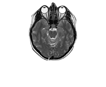 Gehrin MRT Querschnitt Ich denke nach